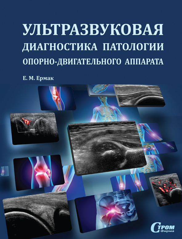 Obl